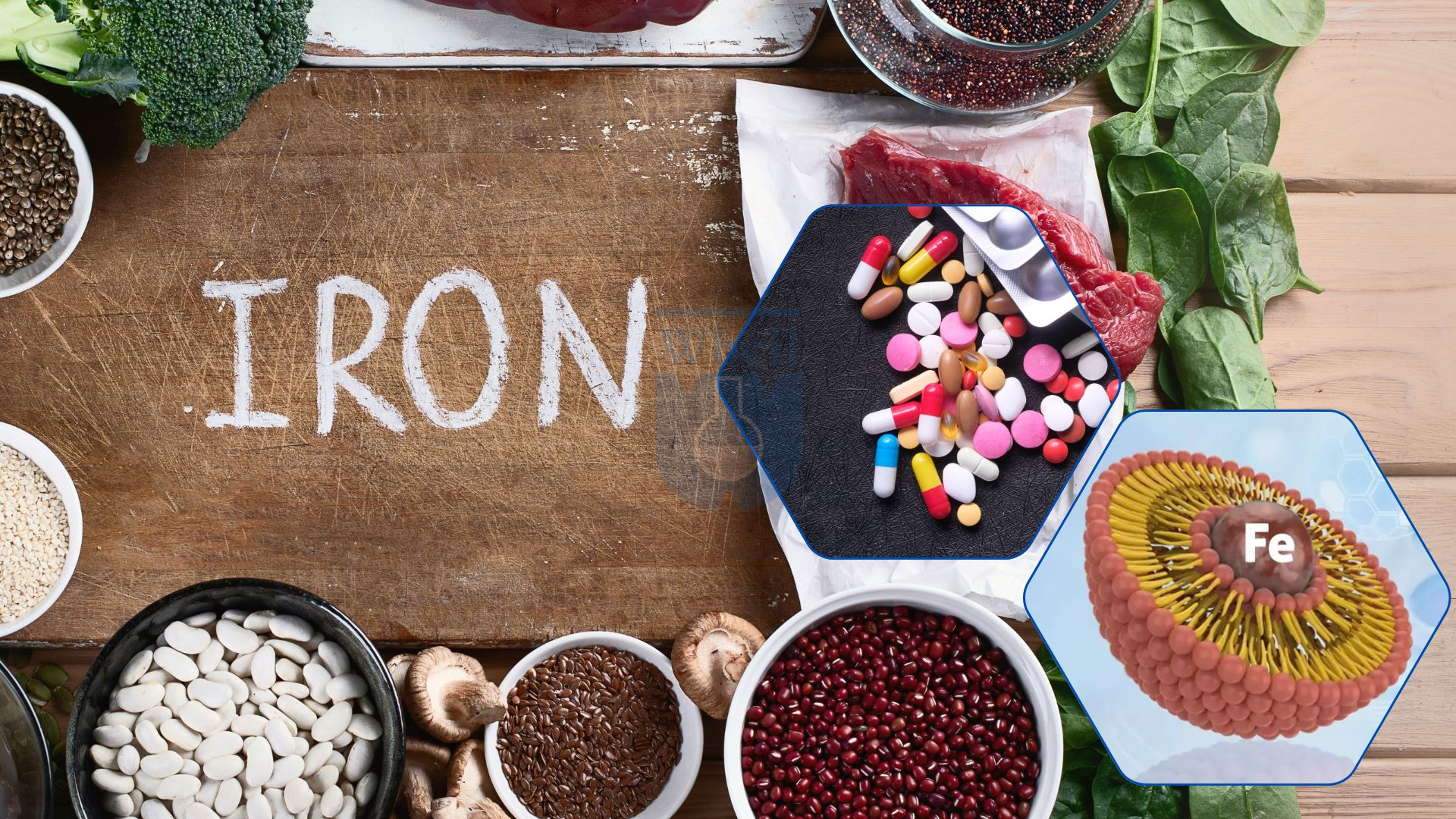 Ferric Derisomaltose and Liposomal Iron in Nutraceutical